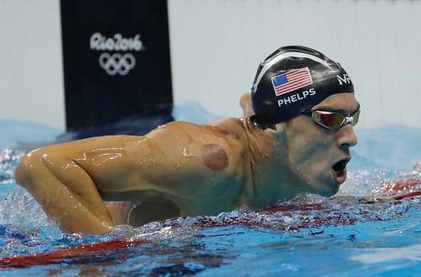 phelps cupping